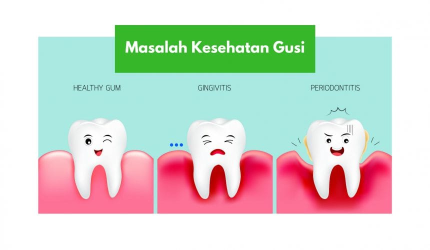 Masalah Kesehatan Gusi: Sakit, Bengkak dan Pendarahan Gusi Masalah Kesehatan Gusi: Sakit, Bengkak dan Pendarahan Gusi