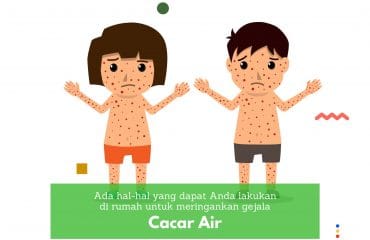 cacar air