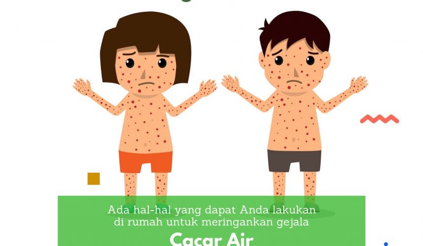 Penanganan Untuk Cacar Air Penanganan Untuk Cacar Air