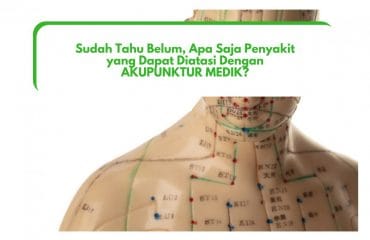 Serba-Serbi Akupunktur: Akupunktur Mengatasi 12 Penyakit Ini