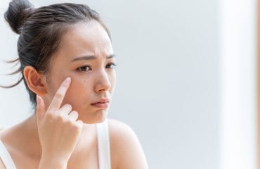 Tanda Skincare Tidak Bekerja dengan Baik