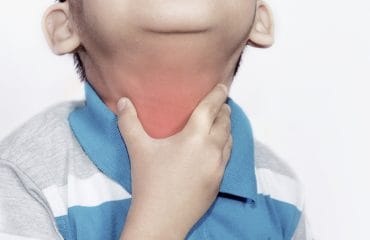 Radang Saat Puasa? Atasi dengan Cara Ini!