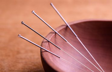 Mengejutkan 8 Manfaat Akupunktur Ini!