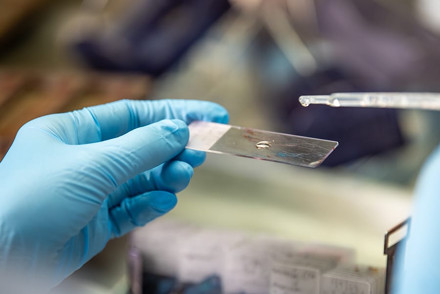 Menyikapi Perbedaan Iva Test dan Pap Smear untuk Deteksi Dini Kanker Serviks