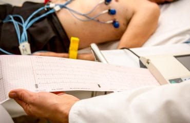 Pemeriksaan EKG