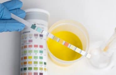 tes urine