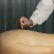 Dry Needling: Prosedur, Manfaat, dan Efek Sampingnya Dry Needling: Prosedur, Manfaat, dan Efek Sampingnya