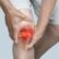 Osteoarthritis adalah  Osteoarthritis adalah